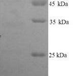 SDS-PAGE separation of QP9158 followed by commassie total protein stain results in a primary band consistent with reported data for Glypican-3. These data demonstrate Greater than 90% as determined by SDS-PAGE.