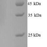 SDS-PAGE separation of QP9161 followed by commassie total protein stain results in a primary band consistent with reported data for Glucose-6-phosphate isomerase. These data demonstrate Greater than 90% as determined by SDS-PAGE.