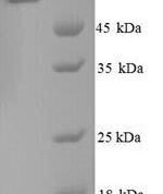 SDS-PAGE separation of QP9161 followed by commassie total protein stain results in a primary band consistent with reported data for Glucose-6-phosphate isomerase. These data demonstrate Greater than 90% as determined by SDS-PAGE.
