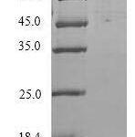 SDS-PAGE separation of QP9175 followed by commassie total protein stain results in a primary band consistent with reported data for Orexin receptor type 2. These data demonstrate Greater than 90% as determined by SDS-PAGE.