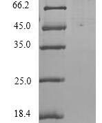 SDS-PAGE separation of QP9175 followed by commassie total protein stain results in a primary band consistent with reported data for Orexin receptor type 2. These data demonstrate Greater than 90% as determined by SDS-PAGE.