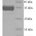 SDS-PAGE separation of QP9180 followed by commassie total protein stain results in a primary band consistent with reported data for Heme oxygenase 1. These data demonstrate Greater than 90% as determined by SDS-PAGE.