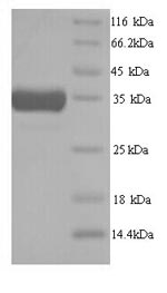 SDS-PAGE separation of QP9180 followed by commassie total protein stain results in a primary band consistent with reported data for Heme oxygenase 1. These data demonstrate Greater than 90% as determined by SDS-PAGE.