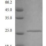 SDS-PAGE separation of QP9199 followed by commassie total protein stain results in a primary band consistent with reported data for IFNAR2 / IFNABR. These data demonstrate Greater than 90% as determined by SDS-PAGE.