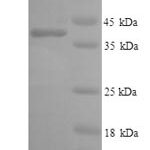 SDS-PAGE separation of QP9217 followed by commassie total protein stain results in a primary band consistent with reported data for IL6R / CD126. These data demonstrate Greater than 90% as determined by SDS-PAGE.