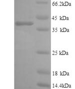 SDS-PAGE separation of QP9217 followed by commassie total protein stain results in a primary band consistent with reported data for IL6R / CD126. These data demonstrate Greater than 90% as determined by SDS-PAGE.