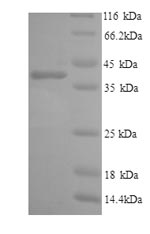 SDS-PAGE separation of QP9217 followed by commassie total protein stain results in a primary band consistent with reported data for IL6R / CD126. These data demonstrate Greater than 90% as determined by SDS-PAGE.