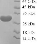 SDS-PAGE separation of QP9228 followed by commassie total protein stain results in a primary band consistent with reported data for KCND2. These data demonstrate Greater than 90% as determined by SDS-PAGE.