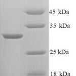 SDS-PAGE separation of QP9238 followed by commassie total protein stain results in a primary band consistent with reported data for KNG1 / BDK / kininogen-1. These data demonstrate Greater than 90% as determined by SDS-PAGE.