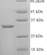 SDS-PAGE separation of QP9238 followed by commassie total protein stain results in a primary band consistent with reported data for KNG1 / BDK / kininogen-1. These data demonstrate Greater than 90% as determined by SDS-PAGE.