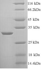 SDS-PAGE separation of QP9238 followed by commassie total protein stain results in a primary band consistent with reported data for KNG1 / BDK / kininogen-1. These data demonstrate Greater than 90% as determined by SDS-PAGE.