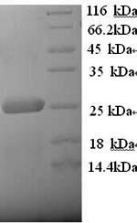 SDS-PAGE separation of QP9256 followed by commassie total protein stain results in a primary band consistent with reported data for LRP2. These data demonstrate Greater than 90% as determined by SDS-PAGE.