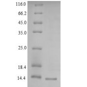 SDS-PAGE separation of QP9259 followed by commassie total protein stain results in a primary band consistent with reported data for Lymphocyte antigen 6H. These data demonstrate Greater than 90% as determined by SDS-PAGE.