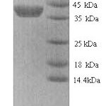 SDS-PAGE separation of QP9280 followed by commassie total protein stain results in a primary band consistent with reported data for MMP-9 / CLG4B. These data demonstrate Greater than 90% as determined by SDS-PAGE.