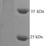 SDS-PAGE separation of QP9281 followed by commassie total protein stain results in a primary band consistent with reported data for MMP-9 / CLG4B. These data demonstrate Greater than 90% as determined by SDS-PAGE.