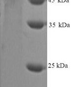 SDS-PAGE separation of QP9281 followed by commassie total protein stain results in a primary band consistent with reported data for MMP-9 / CLG4B. These data demonstrate Greater than 90% as determined by SDS-PAGE.