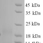 SDS-PAGE separation of QP9291 followed by commassie total protein stain results in a primary band consistent with reported data for Metallothionein-1F. These data demonstrate Greater than 90% as determined by SDS-PAGE.