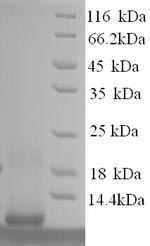 SDS-PAGE separation of QP9291 followed by commassie total protein stain results in a primary band consistent with reported data for Metallothionein-1F. These data demonstrate Greater than 90% as determined by SDS-PAGE.
