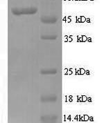 SDS-PAGE separation of QP9298 followed by commassie total protein stain results in a primary band consistent with reported data for N-myc proto-oncogene protein. These data demonstrate Greater than 90% as determined by SDS-PAGE.
