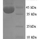 SDS-PAGE separation of QP9309 followed by commassie total protein stain results in a primary band consistent with reported data for NADPH oxidase 4. These data demonstrate Greater than 90% as determined by SDS-PAGE.