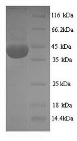 SDS-PAGE separation of QP9309 followed by commassie total protein stain results in a primary band consistent with reported data for NADPH oxidase 4. These data demonstrate Greater than 90% as determined by SDS-PAGE.