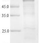 SDS-PAGE separation of QP9317 followed by commassie total protein stain results in a primary band consistent with reported data for Optineurin / OPTN. These data demonstrate Greater than 90% as determined by SDS-PAGE.