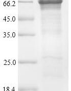 SDS-PAGE separation of QP9317 followed by commassie total protein stain results in a primary band consistent with reported data for Optineurin / OPTN. These data demonstrate Greater than 90% as determined by SDS-PAGE.