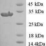 SDS-PAGE separation of QP9334 followed by commassie total protein stain results in a primary band consistent with reported data for PLAUR / CD87 / uPAR. These data demonstrate Greater than 90% as determined by SDS-PAGE.