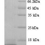 SDS-PAGE separation of QP9354 followed by commassie total protein stain results in a primary band consistent with reported data for PTMA. These data demonstrate Greater than 90% as determined by SDS-PAGE.