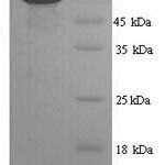 SDS-PAGE separation of QP9356 followed by commassie total protein stain results in a primary band consistent with reported data for CD45 / PTPRC. These data demonstrate Greater than 90% as determined by SDS-PAGE.