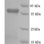 SDS-PAGE separation of QP9364 followed by commassie total protein stain results in a primary band consistent with reported data for Retinol-binding protein 3. These data demonstrate Greater than 90% as determined by SDS-PAGE.