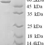 SDS-PAGE separation of QP9381 followed by commassie total protein stain results in a primary band consistent with reported data for S-arrestin. These data demonstrate Greater than 90% as determined by SDS-PAGE.