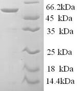 SDS-PAGE separation of QP9381 followed by commassie total protein stain results in a primary band consistent with reported data for S-arrestin. These data demonstrate Greater than 90% as determined by SDS-PAGE.