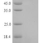 SDS-PAGE separation of QP9438 followed by commassie total protein stain results in a primary band consistent with reported data for Transmembrane 4 L6 family member 1. These data demonstrate Greater than 90% as determined by SDS-PAGE.