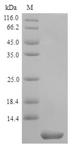 SDS-PAGE separation of QP9438 followed by commassie total protein stain results in a primary band consistent with reported data for Transmembrane 4 L6 family member 1. These data demonstrate Greater than 90% as determined by SDS-PAGE.