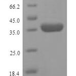 SDS-PAGE separation of QP9439 followed by commassie total protein stain results in a primary band consistent with reported data for Transmembrane protease serine 2. These data demonstrate Greater than 90% as determined by SDS-PAGE.