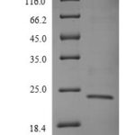 SDS-PAGE separation of QP9445 followed by commassie total protein stain results in a primary band consistent with reported data for T-cell receptor beta-1 chain C region. These data demonstrate Greater than 90% as determined by SDS-PAGE.