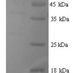 SDS-PAGE separation of QP9447 followed by commassie total protein stain results in a primary band consistent with reported data for E3 ubiquitin-protein ligase TRIM21. These data demonstrate Greater than 90% as determined by SDS-PAGE.