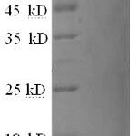 SDS-PAGE separation of QP9449 followed by commassie total protein stain results in a primary band consistent with reported data for TALLA-1 / TSPAN7. These data demonstrate Greater than 90% as determined by SDS-PAGE.