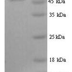 SDS-PAGE separation of QP9459 followed by commassie total protein stain results in a primary band consistent with reported data for Uromodulin. These data demonstrate Greater than 90% as determined by SDS-PAGE.