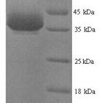 SDS-PAGE separation of QP9471 followed by commassie total protein stain results in a primary band consistent with reported data for Nuclease-sensitive element-binding protein 1. These data demonstrate Greater than 90% as determined by SDS-PAGE.