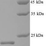 SDS-PAGE separation of QP9509 followed by commassie total protein stain results in a primary band consistent with reported data for Capsid protein. These data demonstrate Greater than 90% as determined by SDS-PAGE.