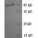 SDS-PAGE separation of QP9517 followed by commassie total protein stain results in a primary band consistent with reported data for Botulinum neurotoxin type B. These data demonstrate Greater than 90% as determined by SDS-PAGE.