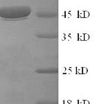 SDS-PAGE separation of QP9540 followed by commassie total protein stain results in a primary band consistent with reported data for Intermediate capsid protein VP6. These data demonstrate Greater than 90% as determined by SDS-PAGE.