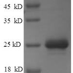 SDS-PAGE separation of QP9542 followed by commassie total protein stain results in a primary band consistent with reported data for Matrix protein. These data demonstrate Greater than 90% as determined by SDS-PAGE.