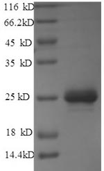 SDS-PAGE separation of QP9542 followed by commassie total protein stain results in a primary band consistent with reported data for Matrix protein. These data demonstrate Greater than 90% as determined by SDS-PAGE.
