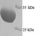 SDS-PAGE separation of QP9561 followed by commassie total protein stain results in a primary band consistent with reported data for HRV-1A. These data demonstrate Greater than 90% as determined by SDS-PAGE.