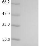 SDS-PAGE separation of QP9585 followed by commassie total protein stain results in a primary band consistent with reported data for Large envelope protein. These data demonstrate Greater than 90% as determined by SDS-PAGE.