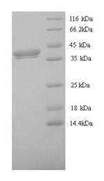 SDS-PAGE separation of QP9601 followed by commassie total protein stain results in a primary band consistent with reported data for Protein Wnt-8. These data demonstrate Greater than 90% as determined by SDS-PAGE.