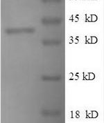 SDS-PAGE separation of QP9625 followed by commassie total protein stain results in a primary band consistent with reported data for Peptidoglycan-binding protein ArfA. These data demonstrate Greater than 90% as determined by SDS-PAGE.